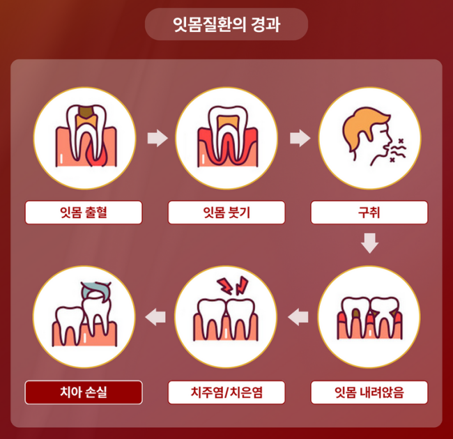 잇순 잇몸붓기 염증 예방 특허성분 입냄새제거 프로폴리스 천일염 병풀 구강청결제